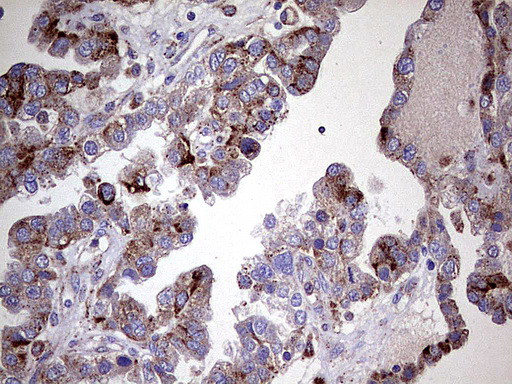 GBA Antibody in Immunohistochemistry (Paraffin) (IHC (P))