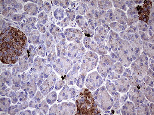 GBA Antibody in Immunohistochemistry (Paraffin) (IHC (P))