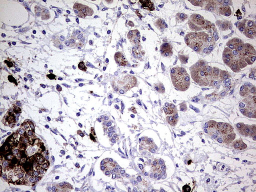 GBA Antibody in Immunohistochemistry (Paraffin) (IHC (P))