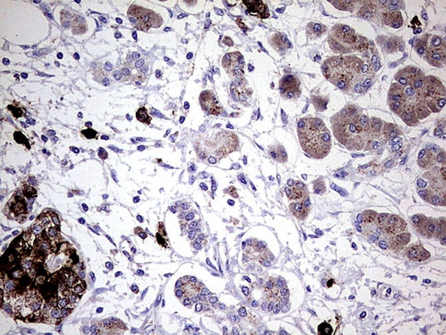 GBA Antibody in Immunohistochemistry (Paraffin) (IHC (P))