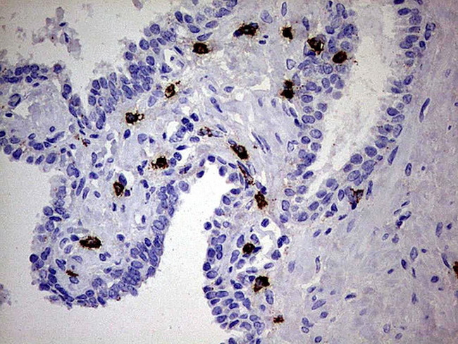 GBA Antibody in Immunohistochemistry (Paraffin) (IHC (P))