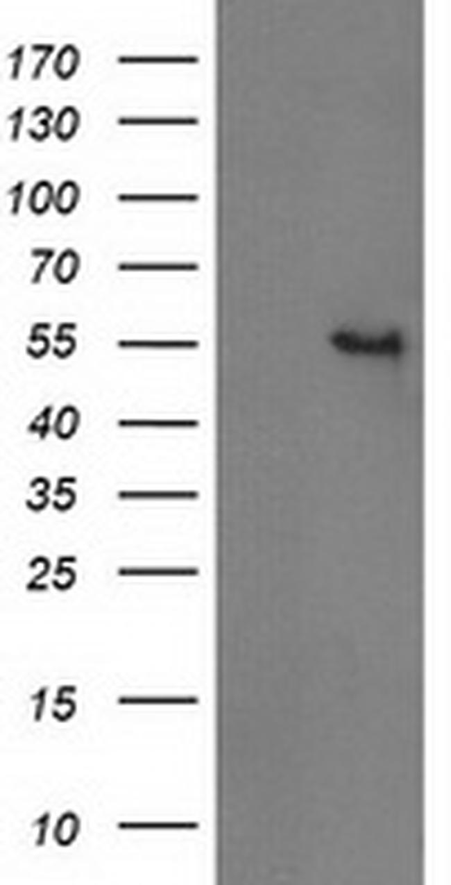 GBA3 Antibody in Western Blot (WB)