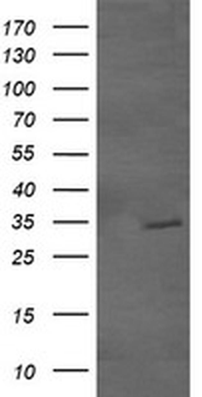 GBAS Antibody in Western Blot (WB)