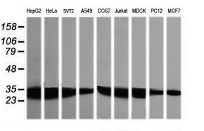 GBAS Antibody in Western Blot (WB)