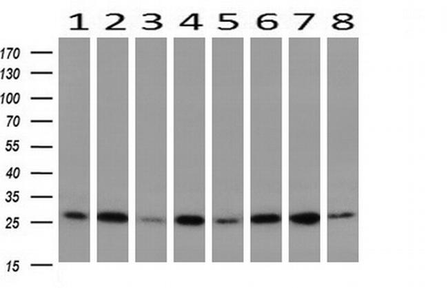 GBAS Antibody in Western Blot (WB)