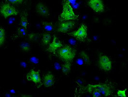 GBE1 Antibody in Immunocytochemistry (ICC/IF)