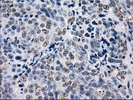 GBE1 Antibody in Immunohistochemistry (Paraffin) (IHC (P))