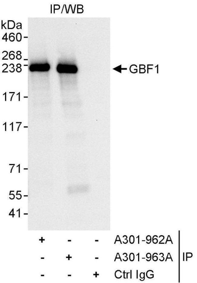 GBF1 Antibody in Immunoprecipitation (IP)