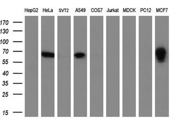 GBP2 Antibody in Western Blot (WB)