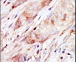 GCK Antibody in Immunohistochemistry (IHC)