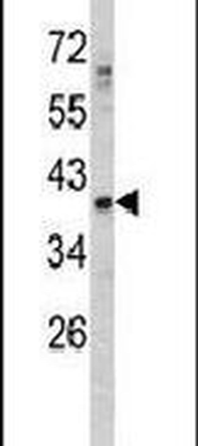 GDF1 Antibody in Western Blot (WB)