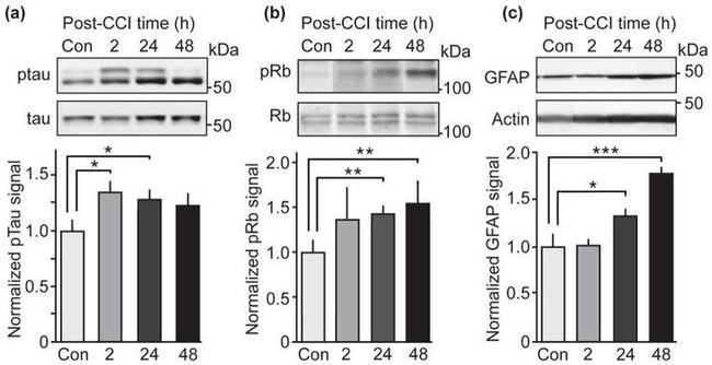 GFAP Antibody in Western Blot (WB)