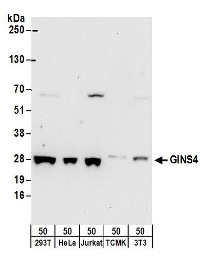 GINS4 Antibody in Western Blot (WB)