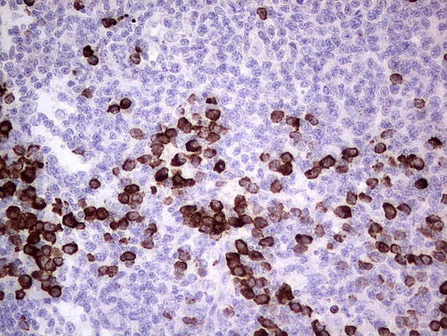 GLI1 Antibody in Immunohistochemistry (Paraffin) (IHC (P))