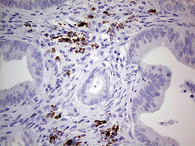 GLI1 Antibody in Immunohistochemistry (Paraffin) (IHC (P))