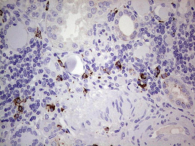 GLI1 Antibody in Immunohistochemistry (Paraffin) (IHC (P))