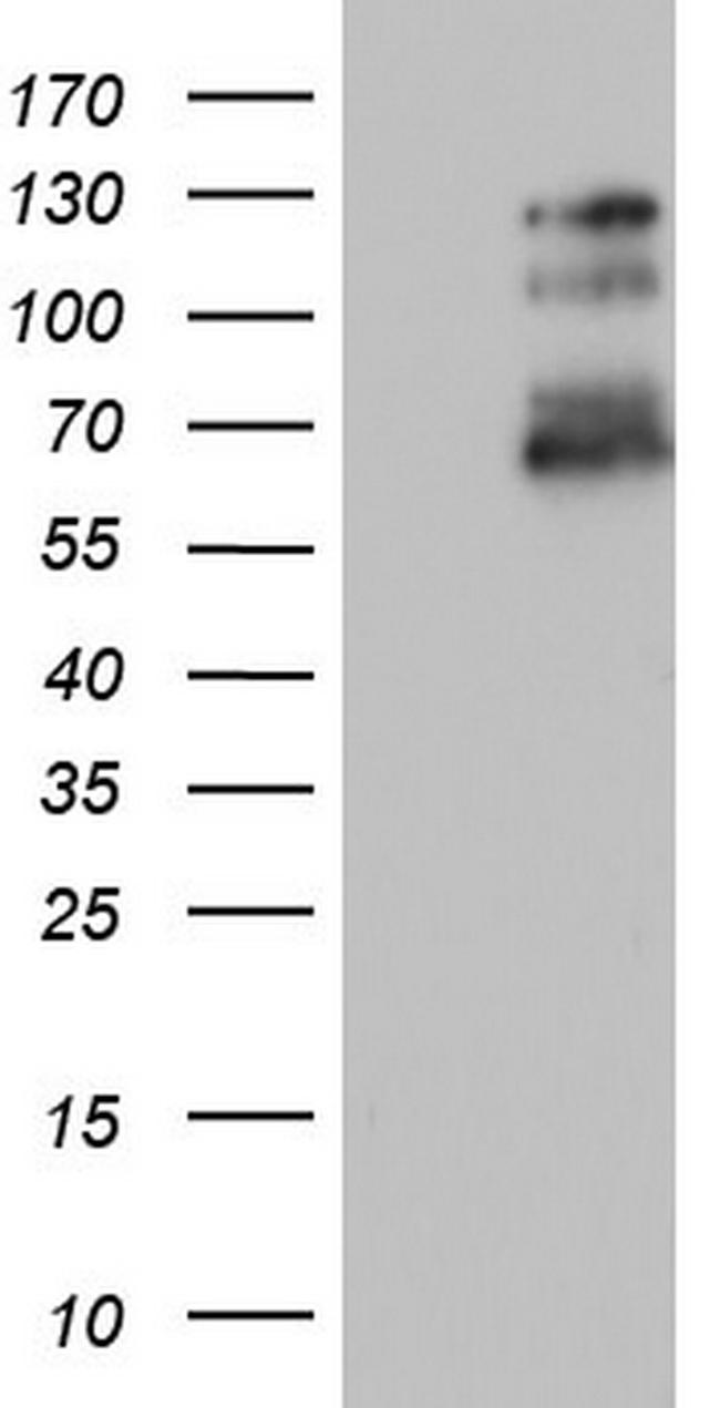 GLI1 Antibody in Western Blot (WB)