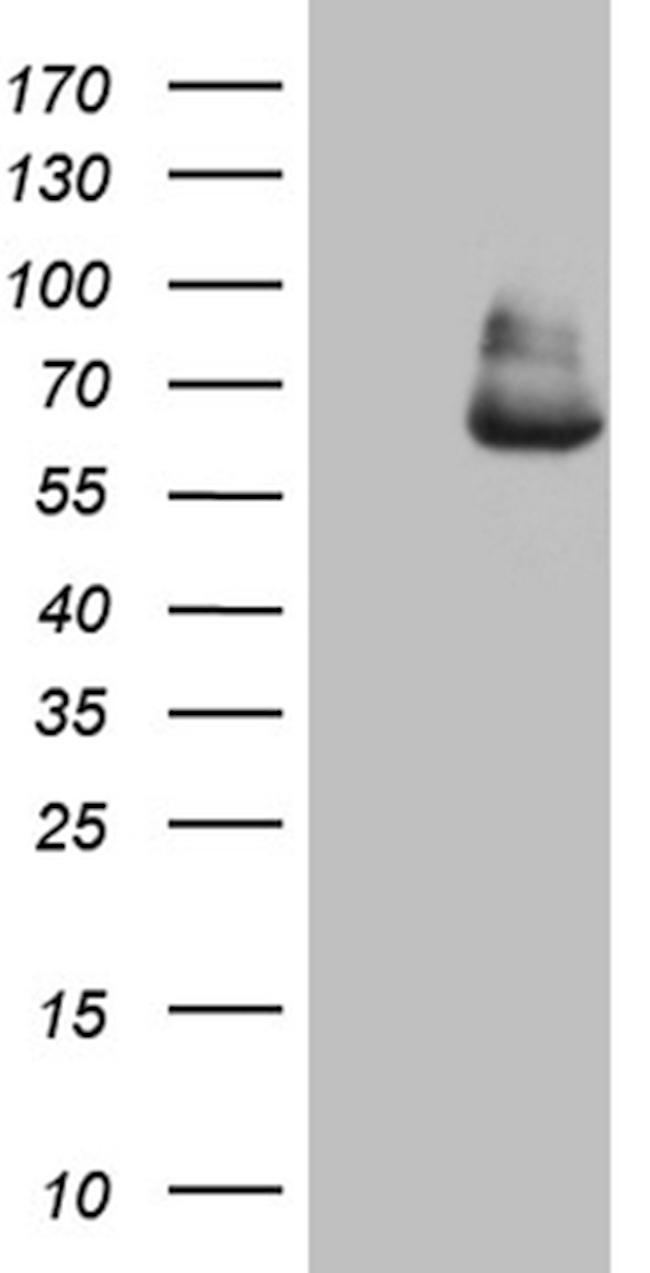 GLS2 Antibody in Western Blot (WB)