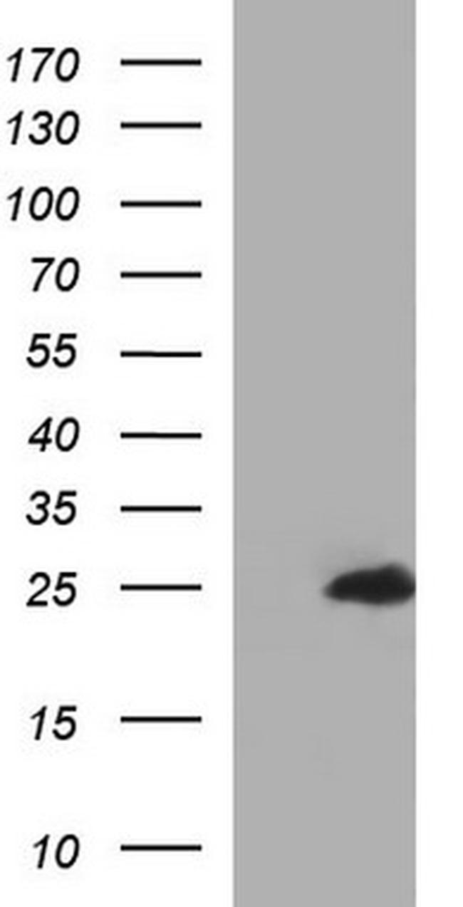 GLTP Antibody in Western Blot (WB)