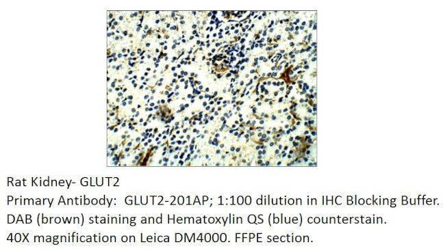 Glucose Transporter GLUT2 Antibody in Immunohistochemistry (IHC)