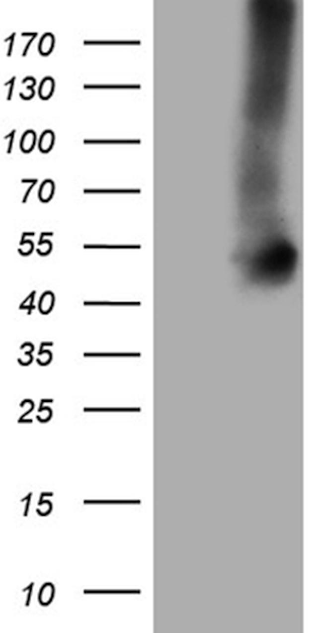 GNAS Antibody in Western Blot (WB)