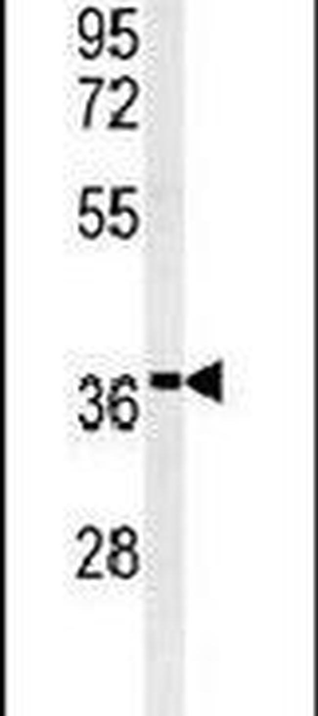 GNB1 Antibody in Western Blot (WB)