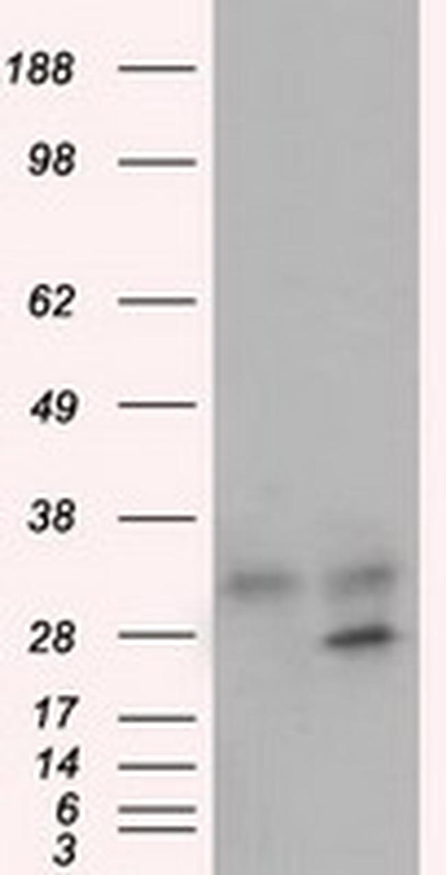 GNMT Antibody in Western Blot (WB)