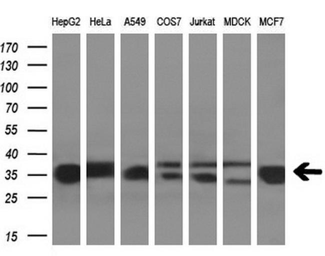 GNMT Antibody in Western Blot (WB)