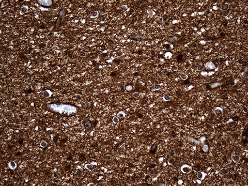 GNPAT Antibody in Immunohistochemistry (Paraffin) (IHC (P))