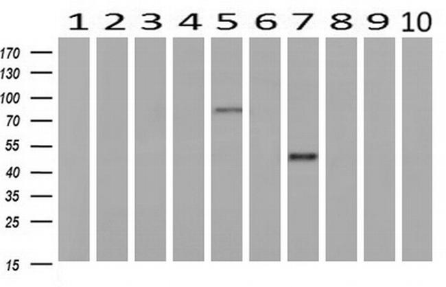 GORASP1 Antibody in Western Blot (WB)