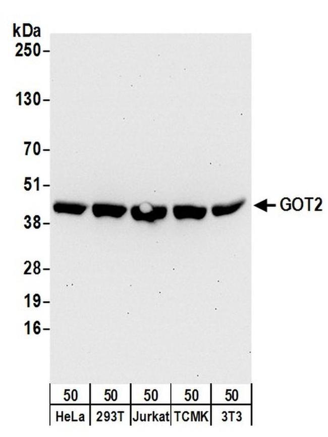 GOT2 Antibody in Western Blot (WB)