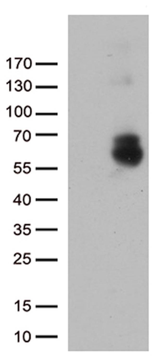 GPC1 Antibody in Western Blot (WB)
