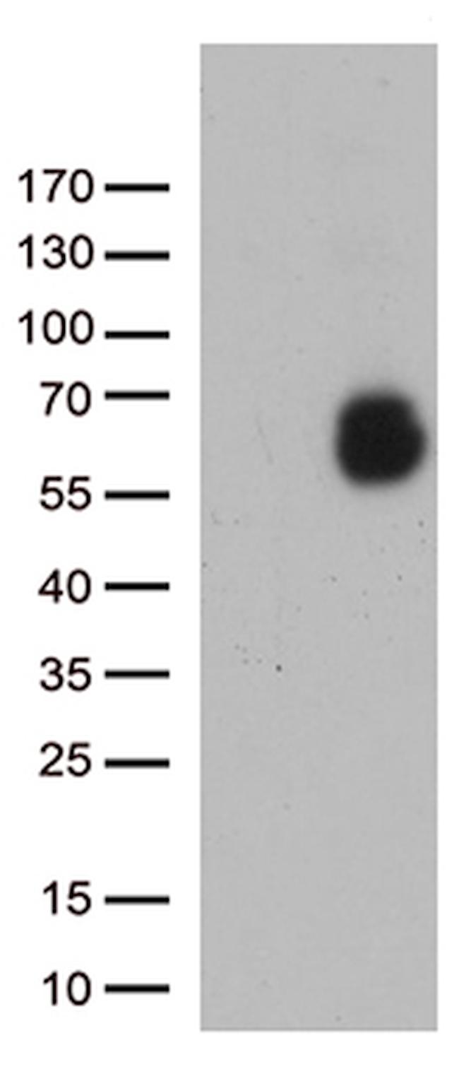 GPC1 Antibody in Western Blot (WB)