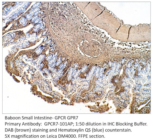 GPCR GPR7 Antibody in Immunohistochemistry (IHC)