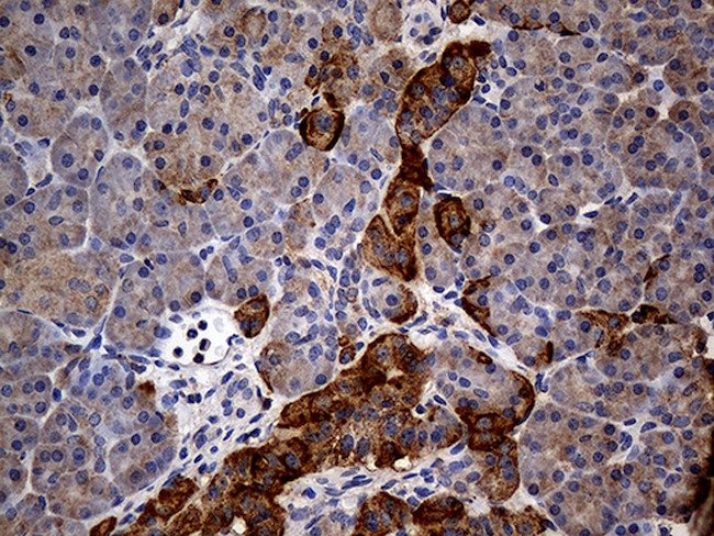 GRB10 Antibody in Immunohistochemistry (Paraffin) (IHC (P))