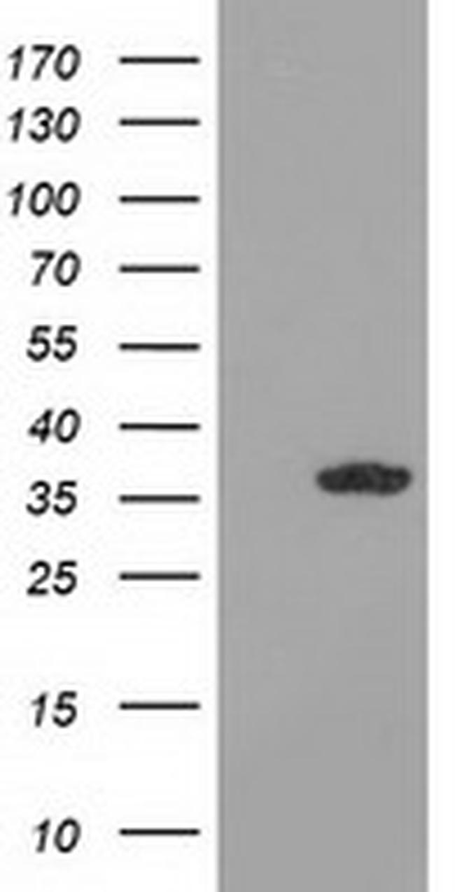 GRHPR Antibody in Western Blot (WB)