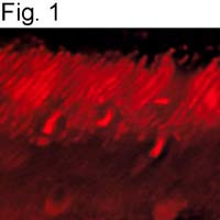 GRK1 Antibody in Immunohistochemistry (IHC)