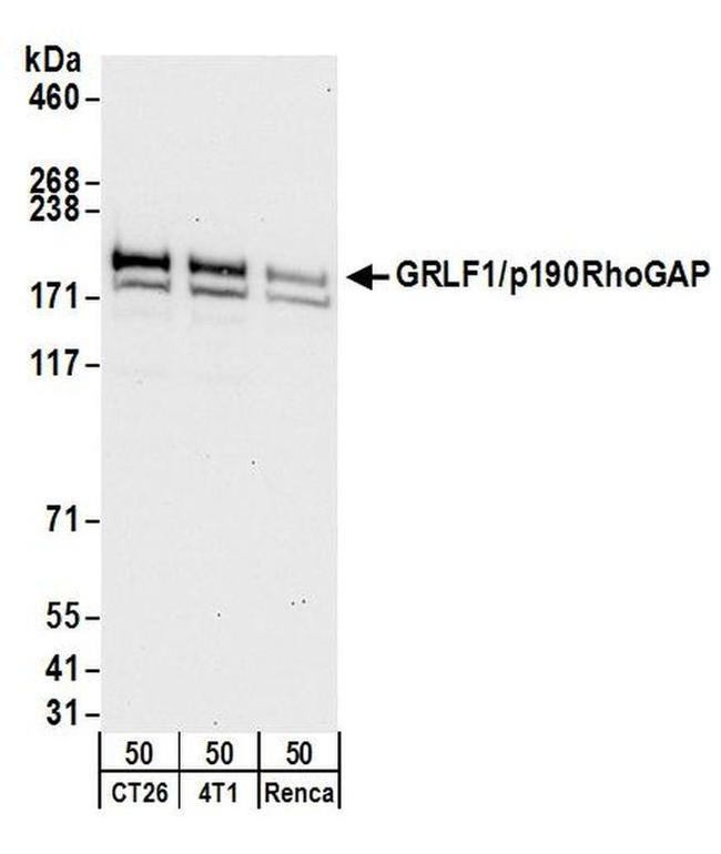 GRLF1/p190RhoGAP Antibody in Western Blot (WB)