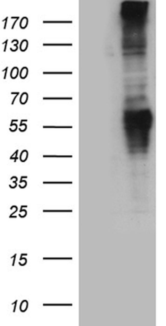 GRM5 Antibody in Western Blot (WB)