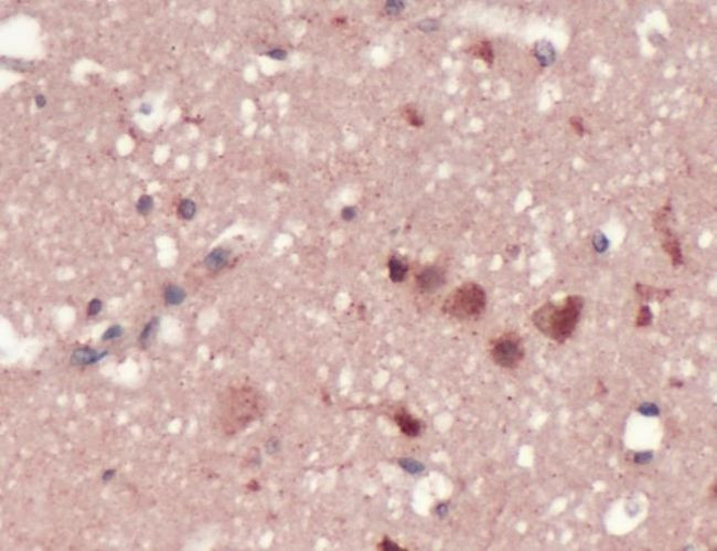 GRSF1 Antibody in Immunohistochemistry (IHC)