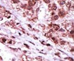 GSK3B Antibody in Immunohistochemistry (IHC)