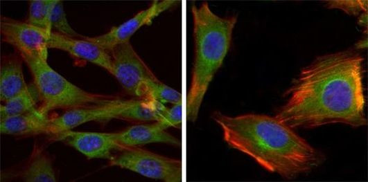 GSK3B Antibody in Immunocytochemistry (ICC/IF)