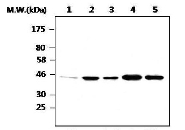 GSK3B Antibody in Western Blot (WB)