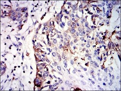 GSTM1 Antibody in Immunohistochemistry (Paraffin) (IHC (P))