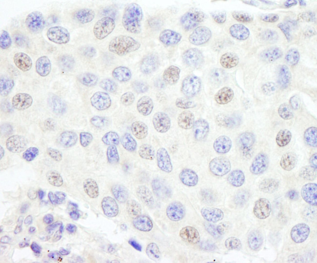 GTF3C1/TFIIIC220 Antibody in Immunohistochemistry (IHC)