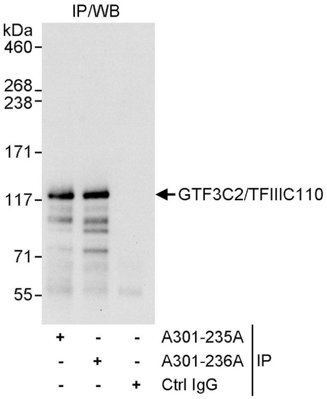 GTF3C2/TFIIIC110 Antibody in Immunoprecipitation (IP)