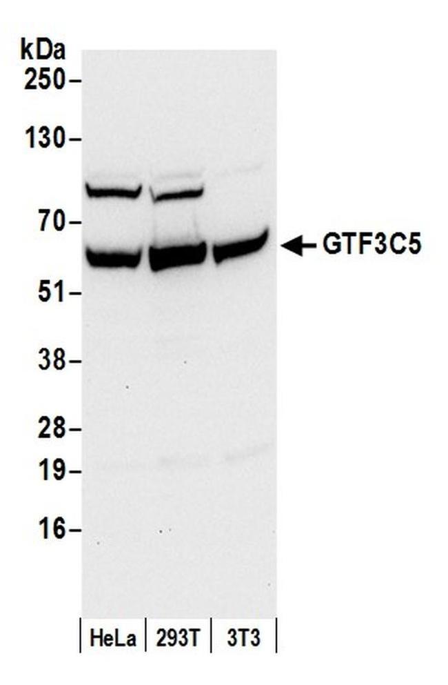 GTF3C5/TFIIIC63 Antibody in Western Blot (WB)