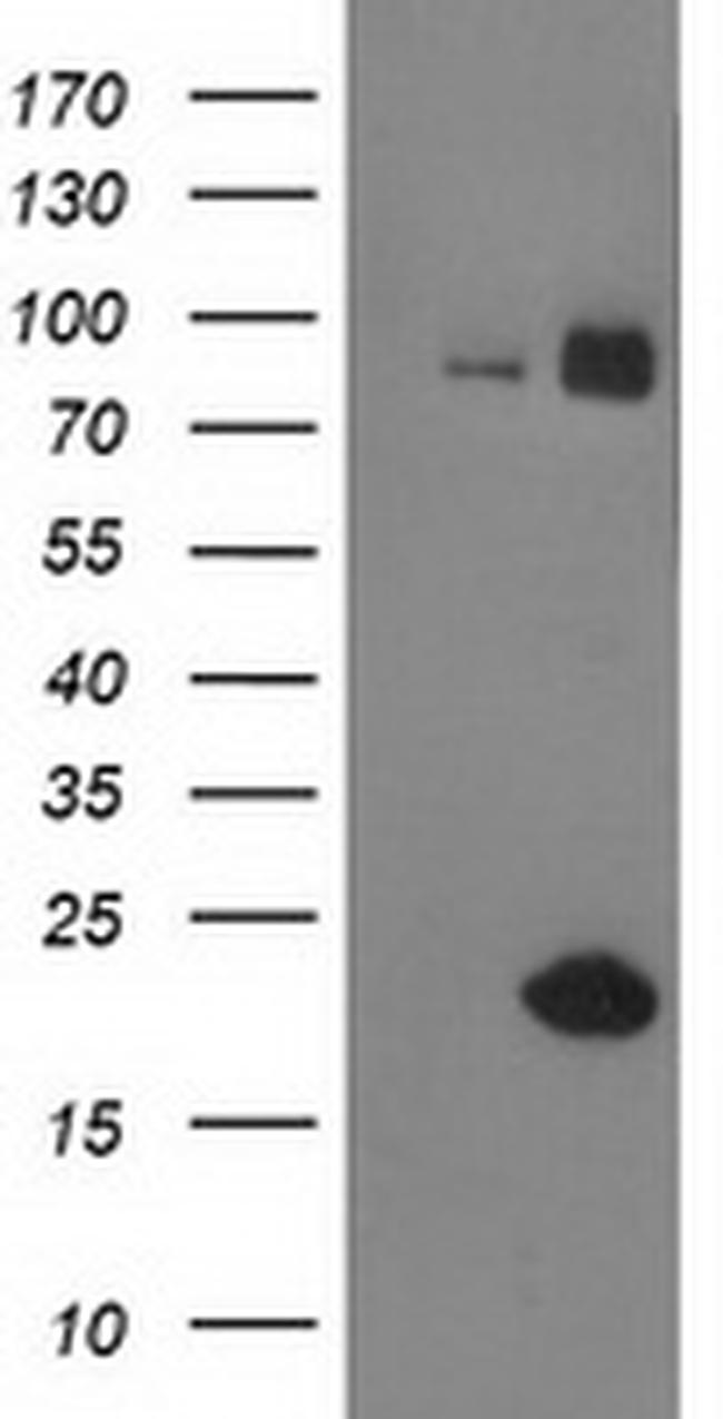 GUK1 Antibody in Western Blot (WB)