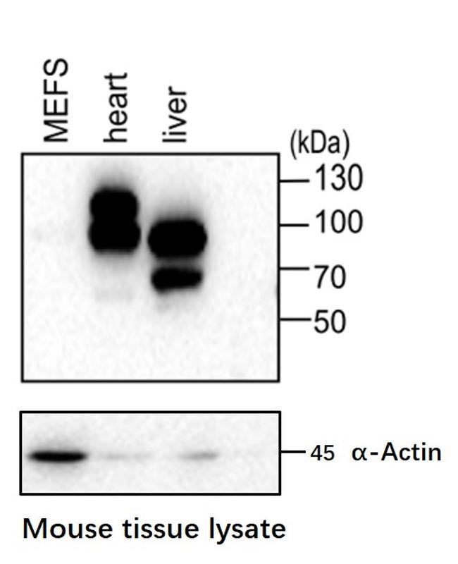 GYS2 Antibody in Western Blot (WB)