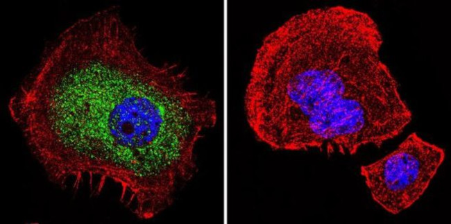 Glucocorticoid Receptor Antibody in Immunocytochemistry (ICC/IF)